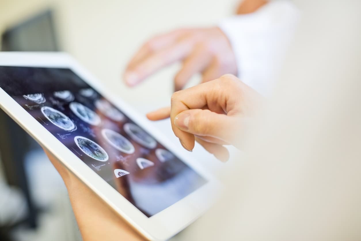 Medizinisches Team analysiert MRT-Scans auf einem digitalen Tablet