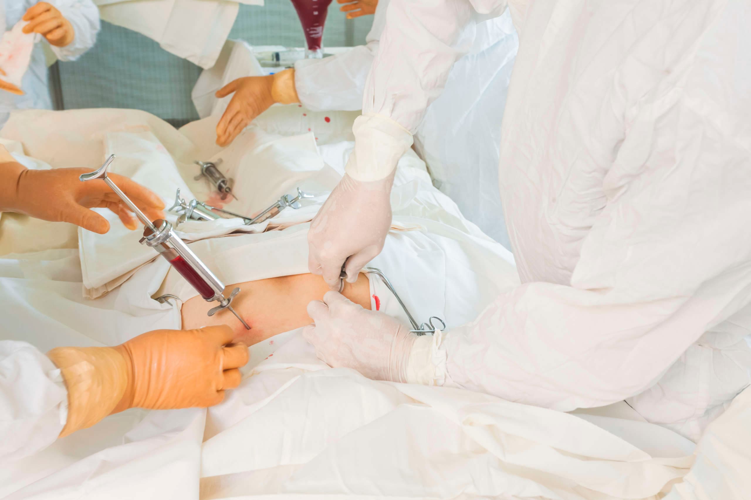 Das Langzeitüberleben von Menschen mit Knochenmarks- und Blutstammzelltransplantationen hat sich in den letzten 40 Jahren stark verbessert &#8211; allerdings nicht für alle Patientengruppen.