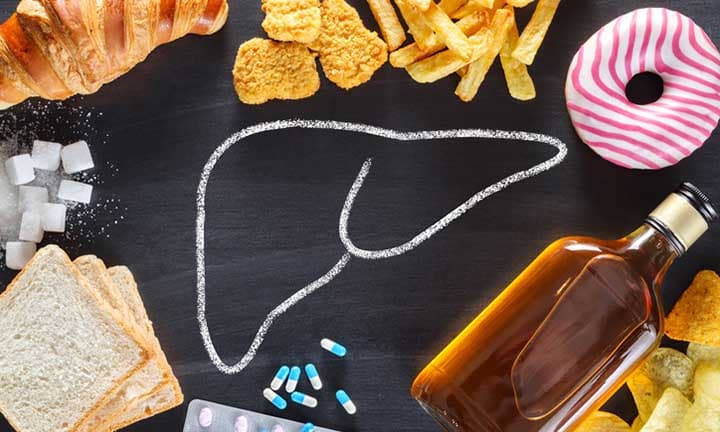 Unhealthy lifestyle - risk of liver damage. Top view