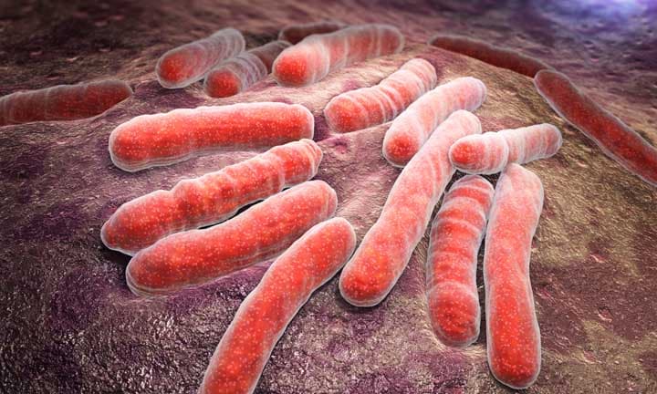 3D-Darstellung einer bakteriellen Infektion von Tuberkulose