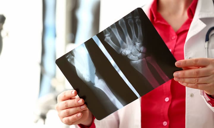 Female radiologist hold in hand x-ray film image aganist hospital office background. CT scan of bone health concept.