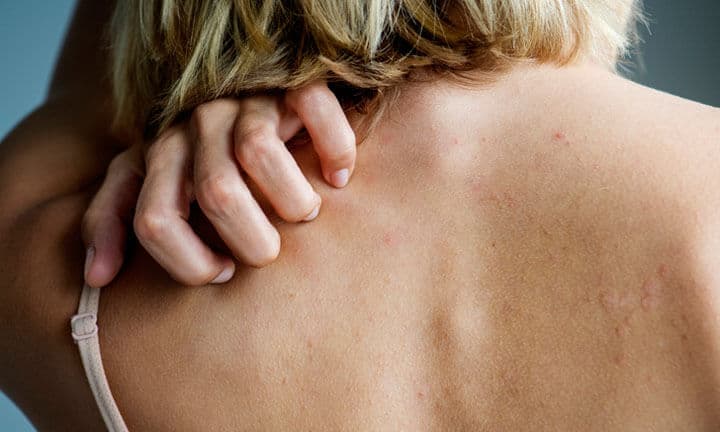 Backside of white woman back pain and ache concept