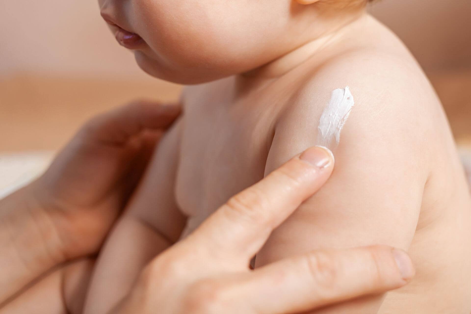 Präventives Einschmieren kann Neurodermitis bei Kindern verhindernbackground