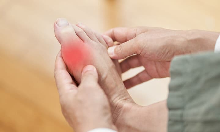The feet of a man suffering from gout