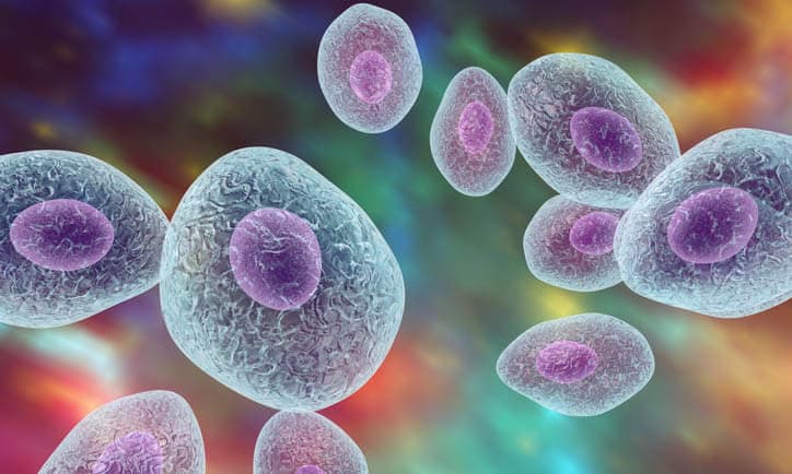 Kein Screening aber Prophylaxe ist möglich: Pneumo­cys­tis-jirovecii-Pneumonie