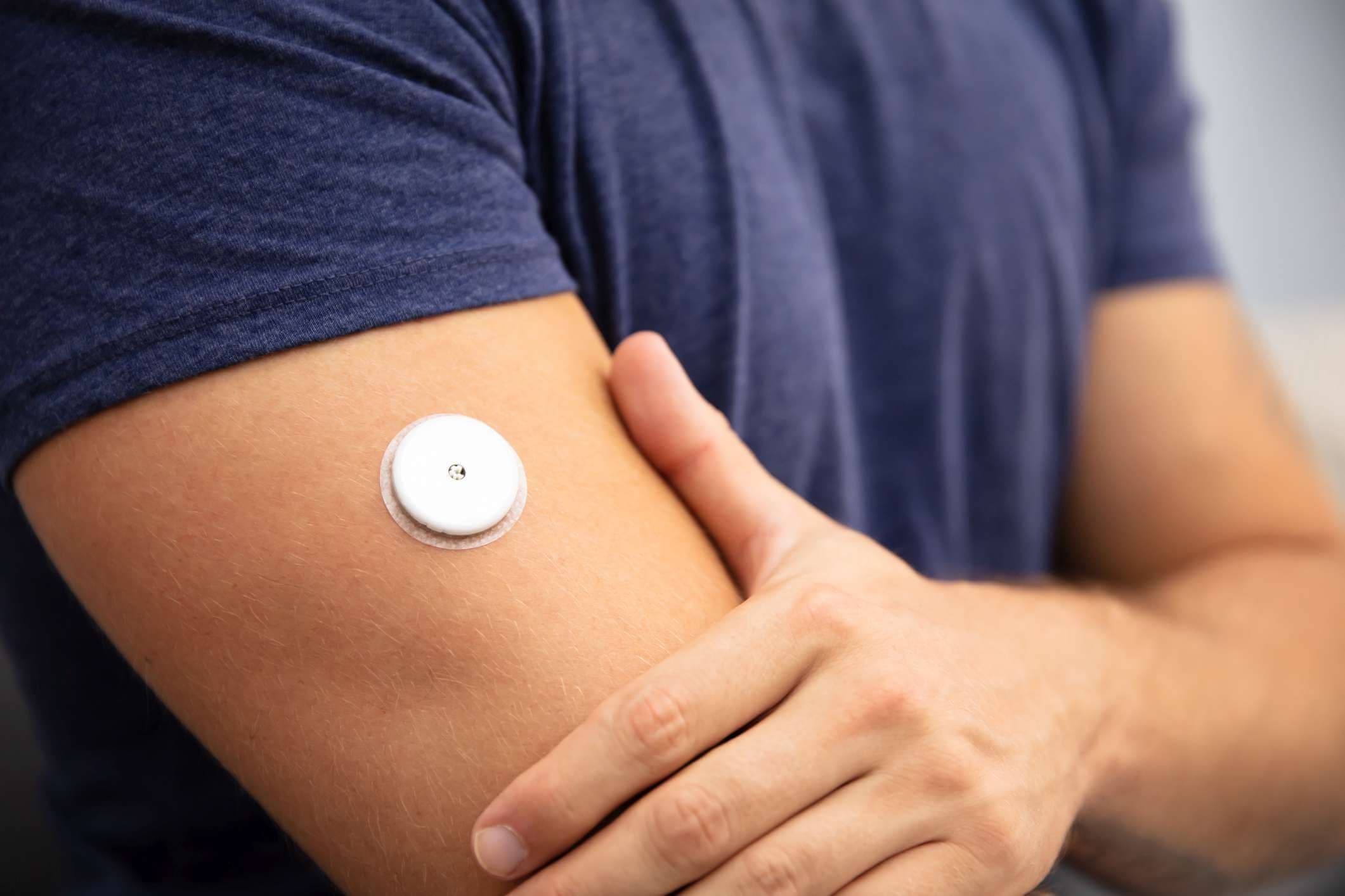 Close-up Of A Man Testing Glucose Level With A Continuous Glucose Monitor On His Arm