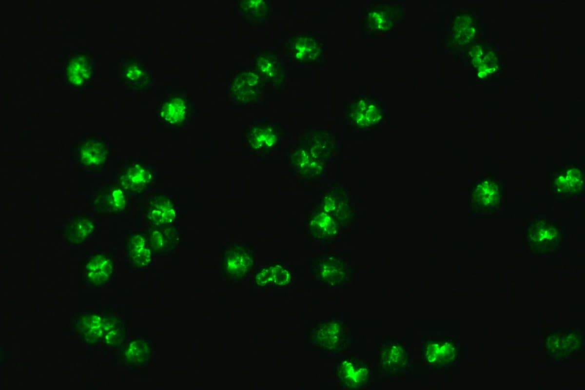 P-ANCA visualisiert durch Immunfluoreszenz auf Neutrophilen.