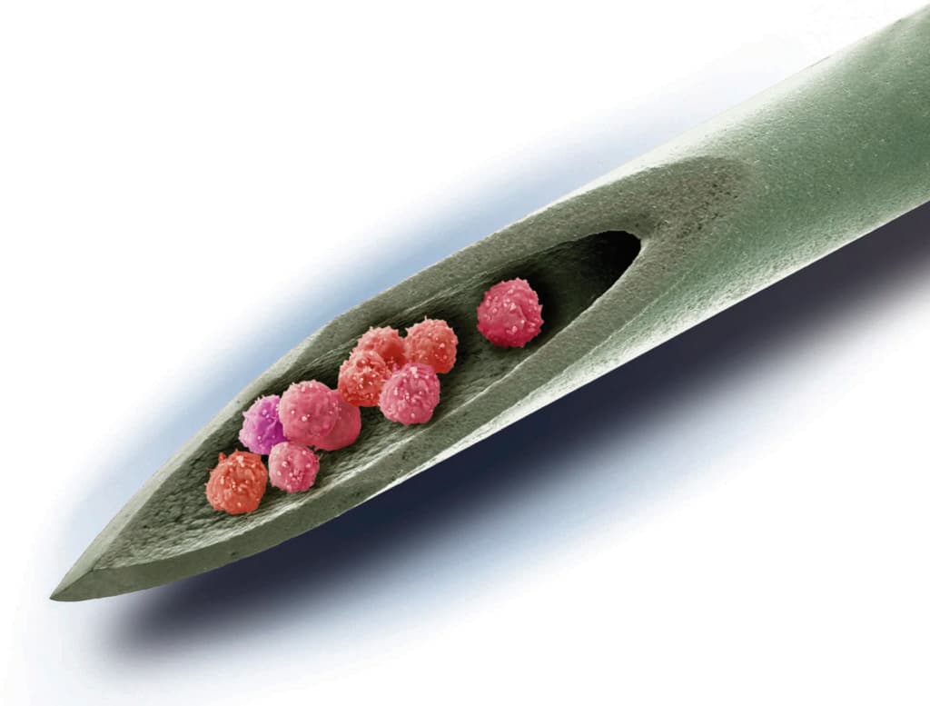 Stem cell therapy,conceptual image. Composite coloured scanning electron micrograph (SEM) of a needle with stem cells inside