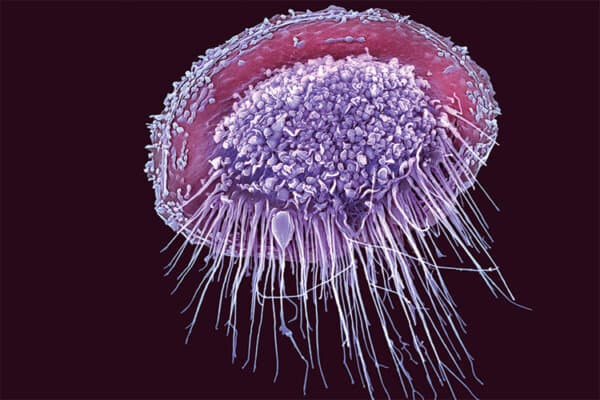 Macrophage