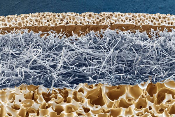 Superabsorber Wundauflage