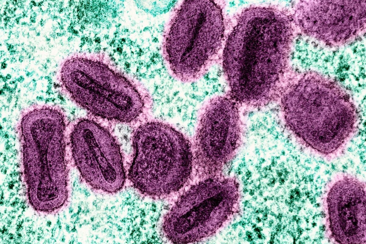 Das Mpox-Virus bereitet weiter Kopfzerbrechen.