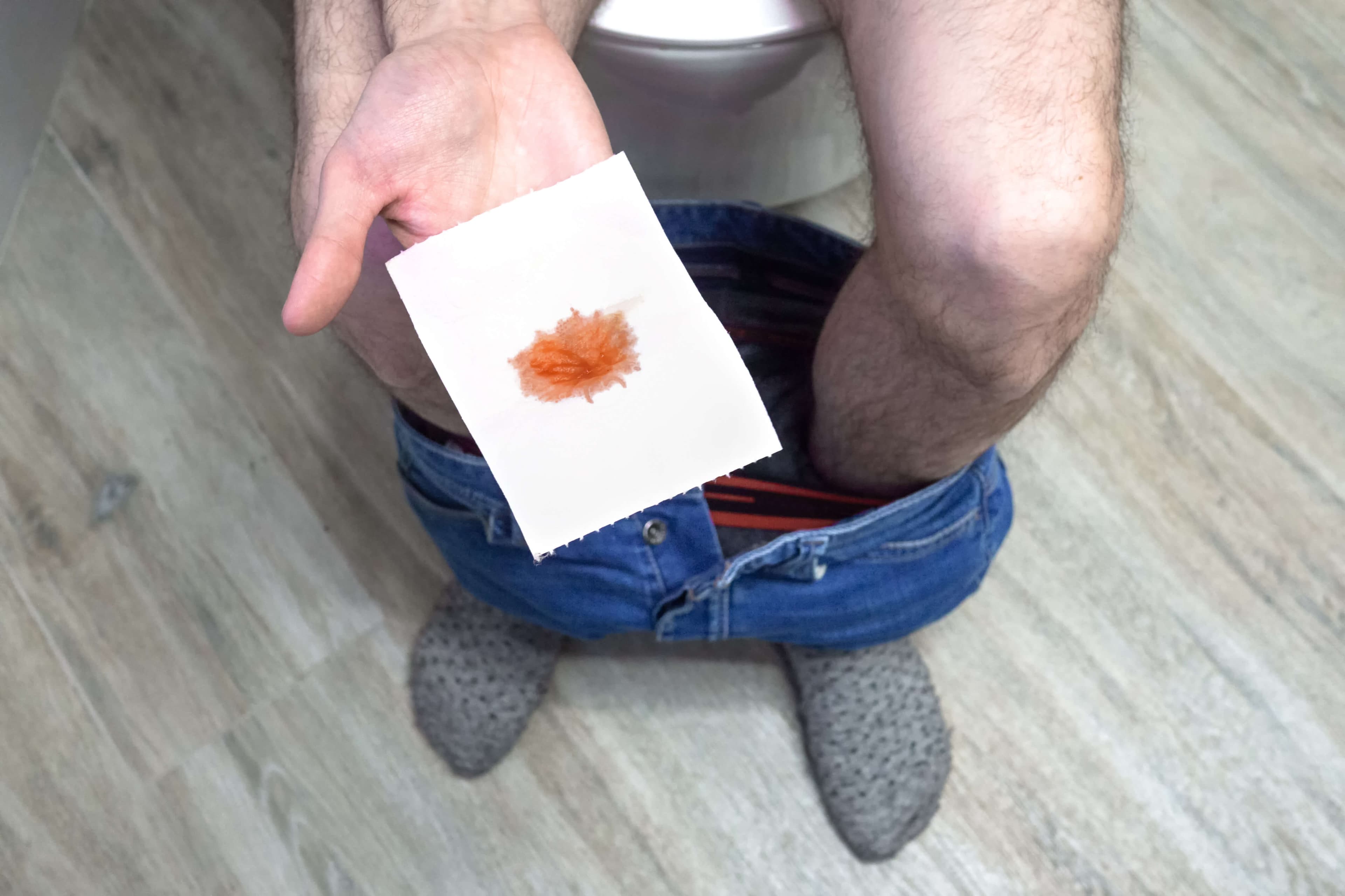 Man holding toilet paper with blood stain in rest room, closeup. Hemorrhoid concept