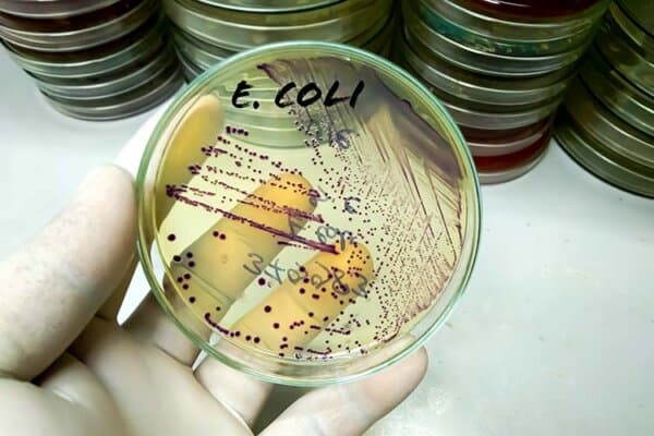 Technologue médical tient Croissance d'une culture bactérienne sur chromogène