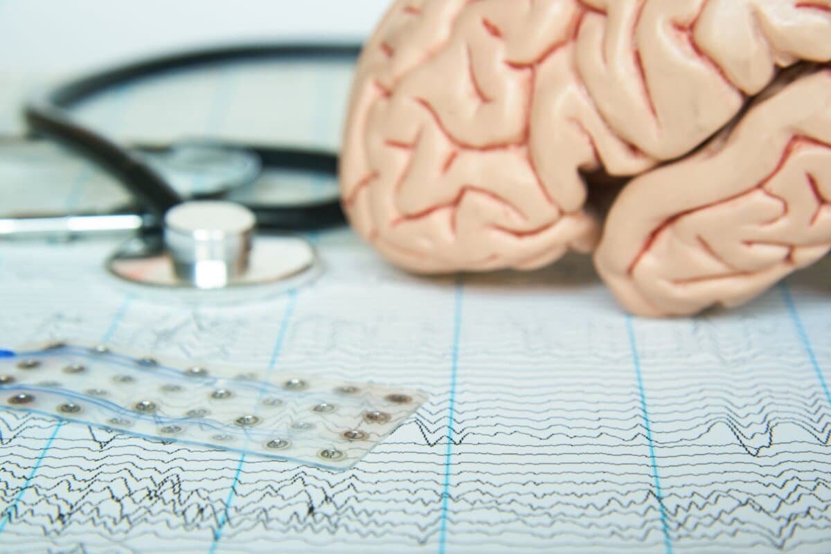Subdural electrode grid on electroencephalograpy paper. Human brain model and a black stethoscope on background.