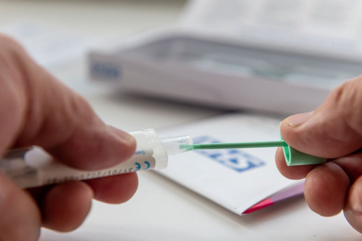 Test auf Blut im Stuhl (FIT).
