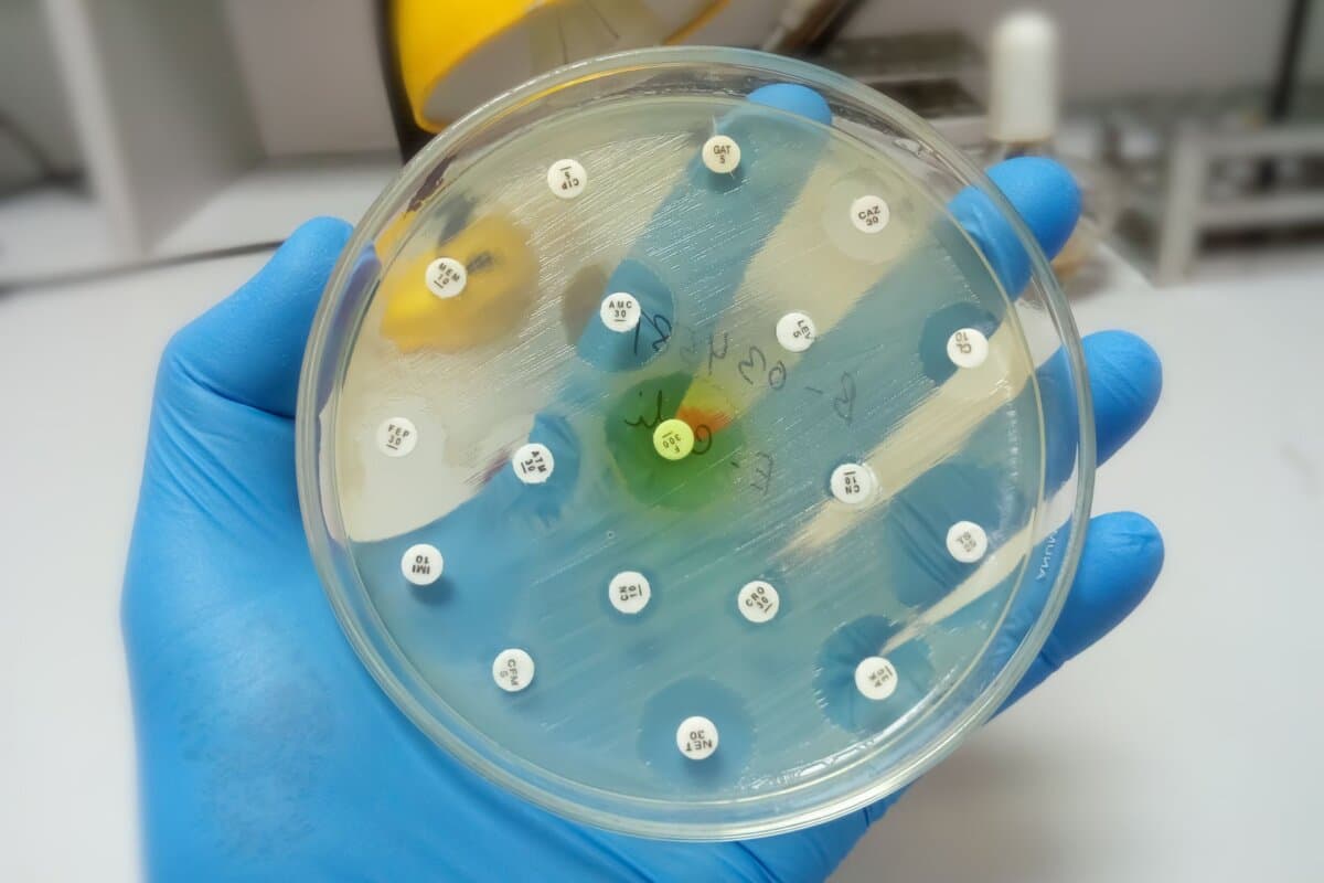 Wissenschaftler halten eine Kulturschale mit Bakterienwachstum, die die Antibiotikaempfindlichkeit der Kolonie zeigt.