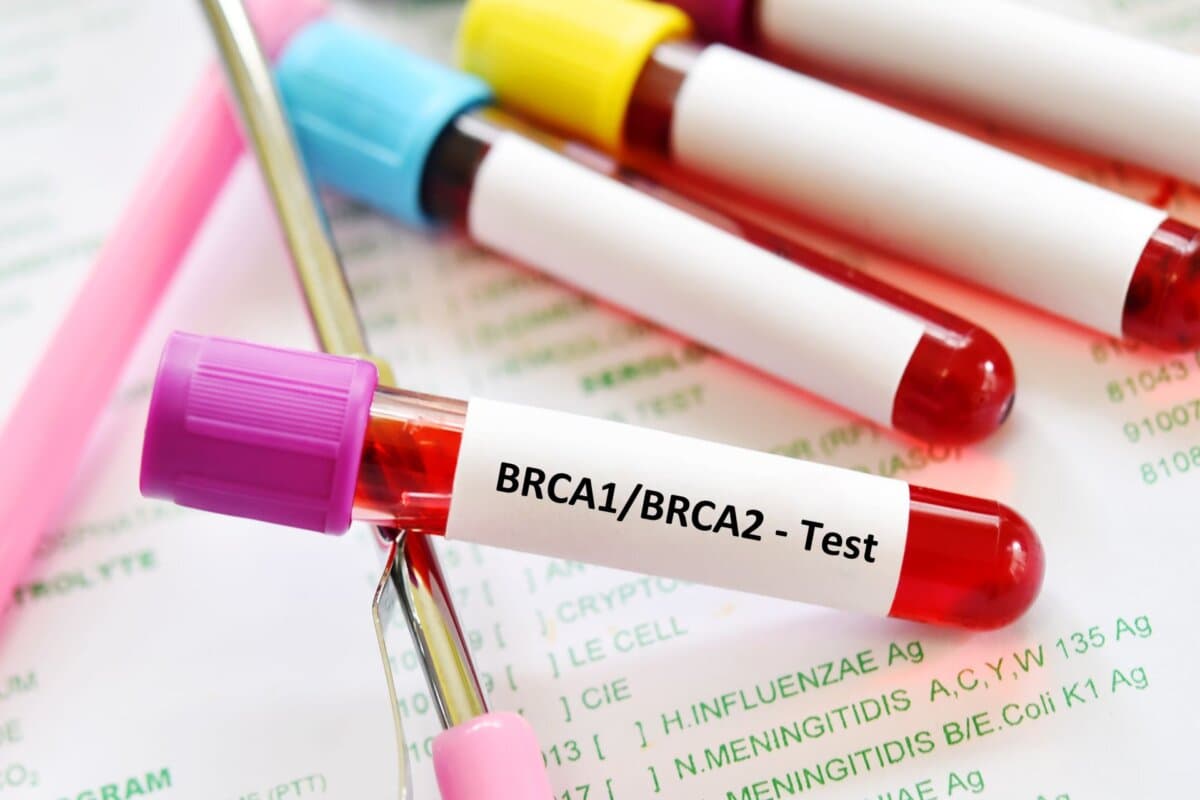 Blutprobe für BRCA1- und BRCA2-Test, Genmarker für Brustkrebs