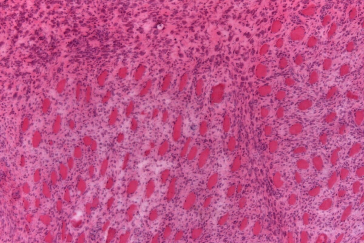 H&E einer proliferativen Myositis