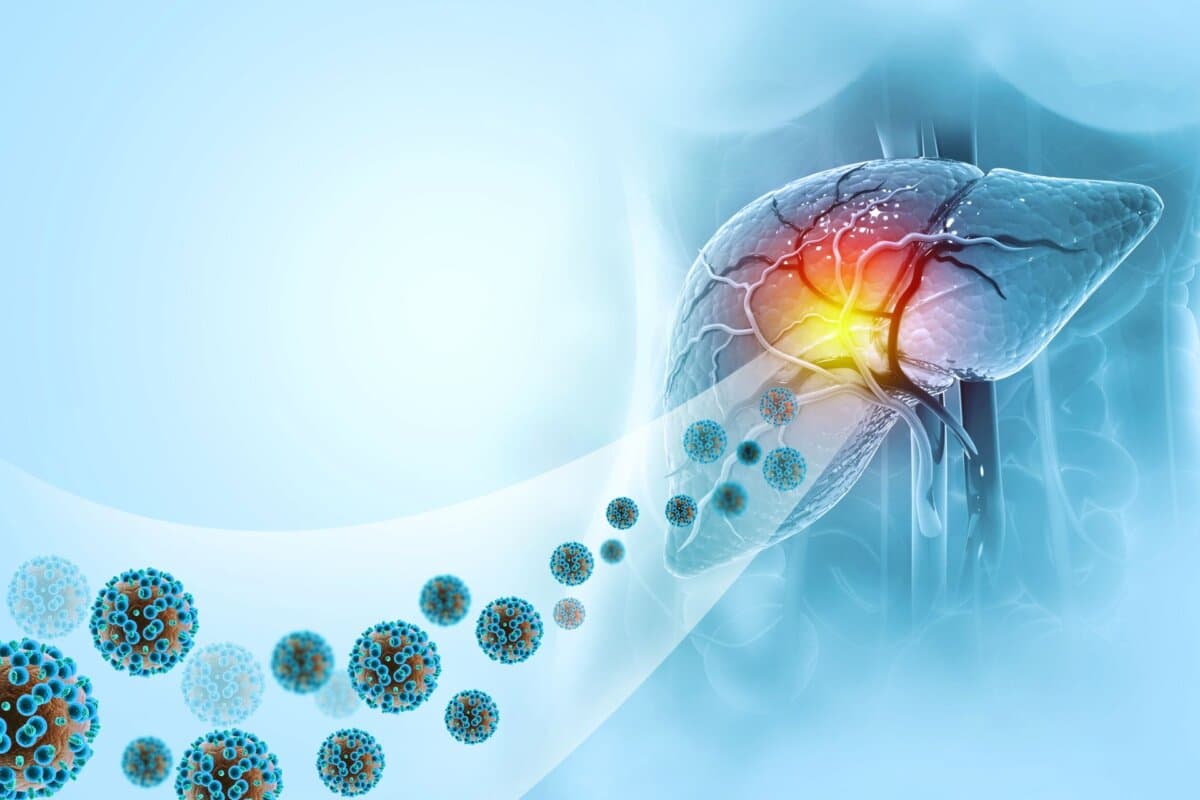 Menschliche Leber mit Hepatitisvirus. 3D-Illustration