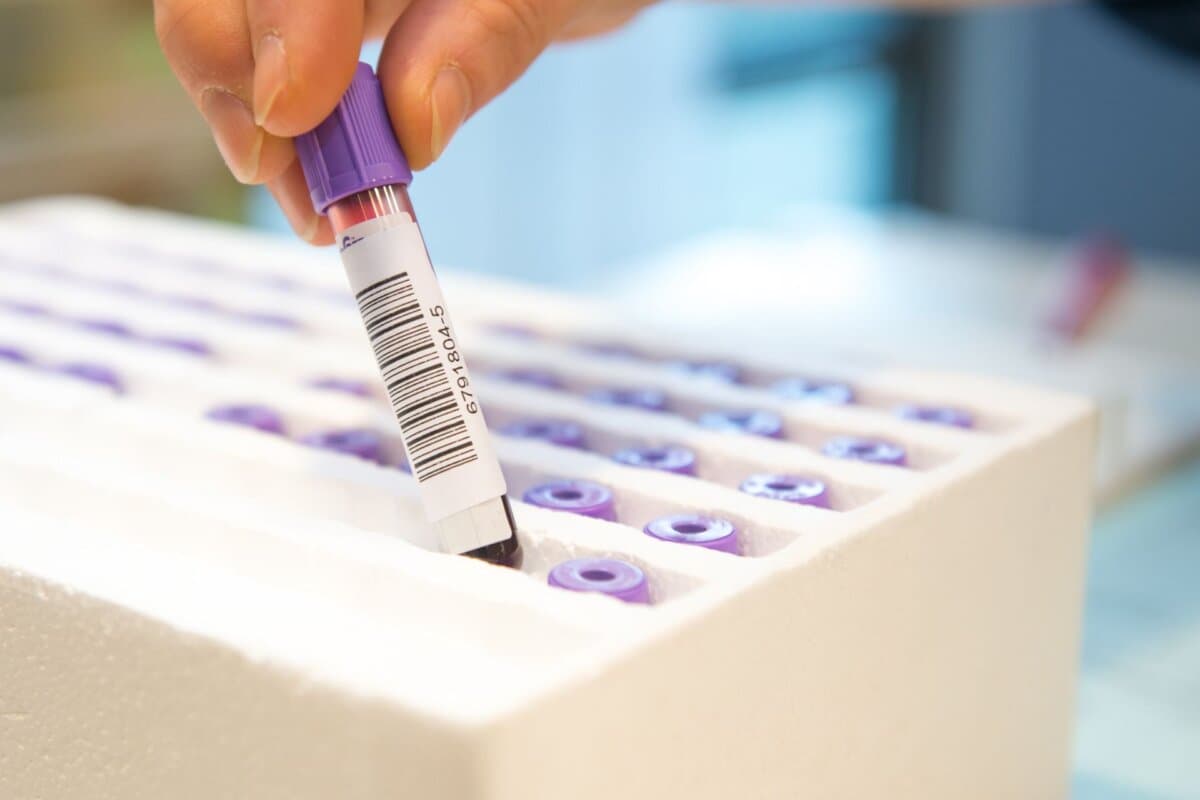 Röhrchen mit einer Blutprobe
