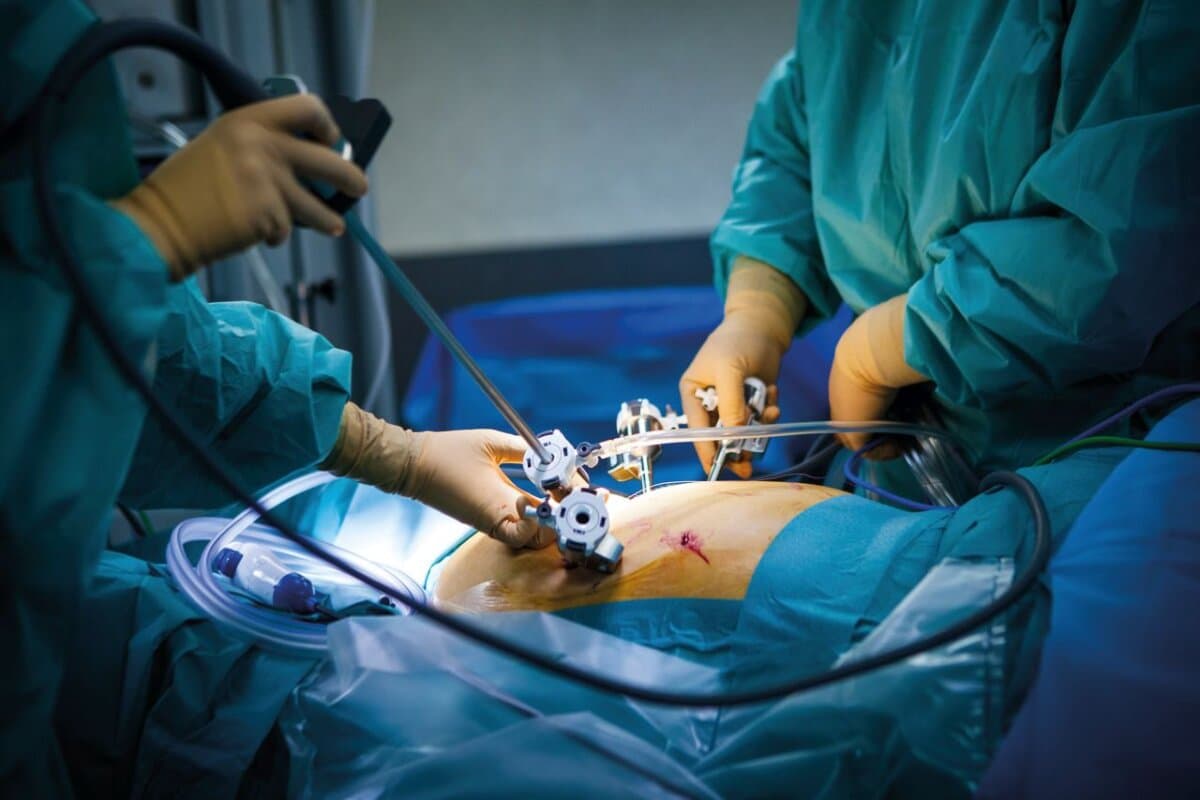 Robotergestützte Hysterektomie im Operationssaal: Der chirurgische Eingriff erfolgt minimalinvasiv mit Unterstützung eines