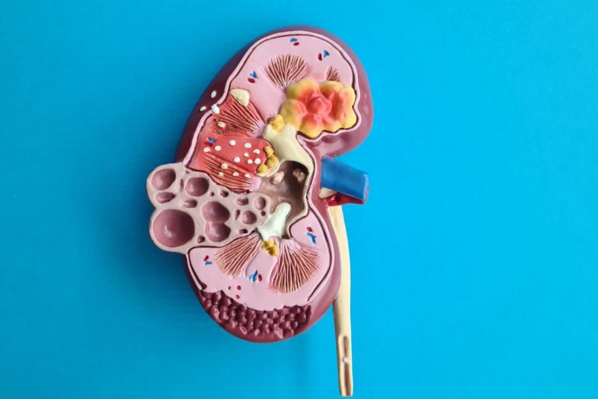 Menschliche Niere im Detail: Symbolbild für die rechtzeitige Diagnose und Therapie von Nierensteinen.