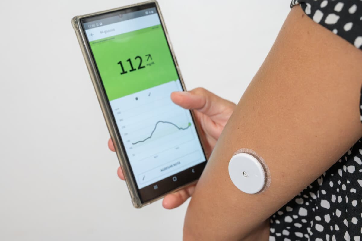 Patientin überprüft ihren Glukoseverlauf per Smartphone, unterstützt durch einen kontinuierlichen Glukosesensor am