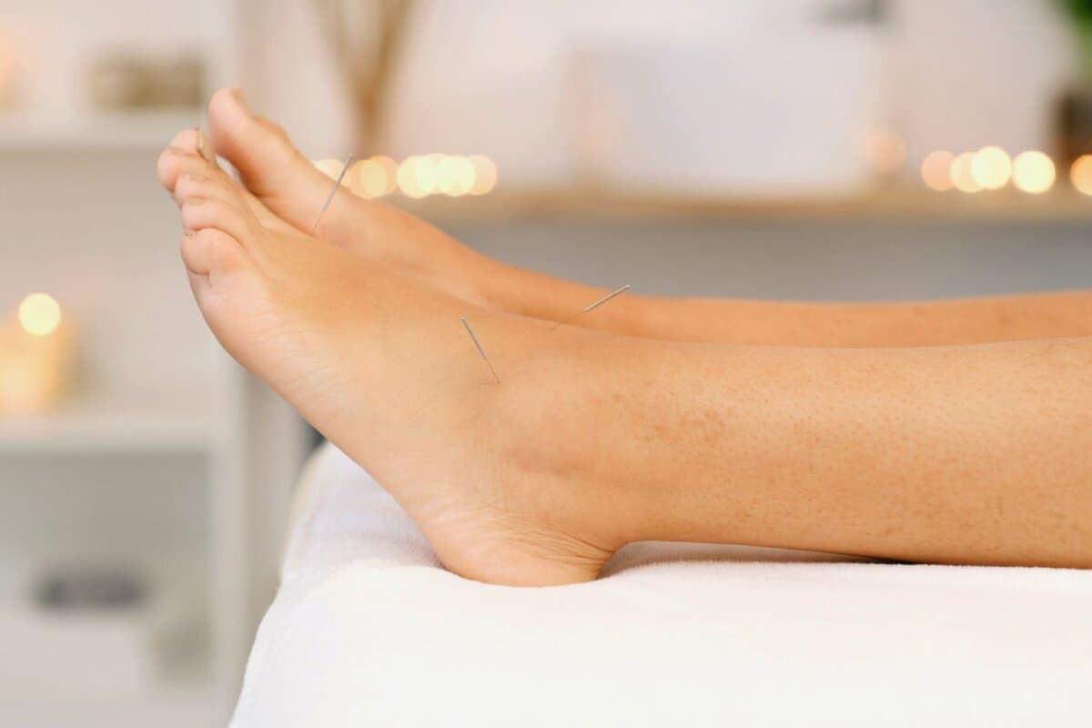 Akupunktur am Fuss im Rahmen einer therapeutischen Anwendung zur Entspannung und Regulation