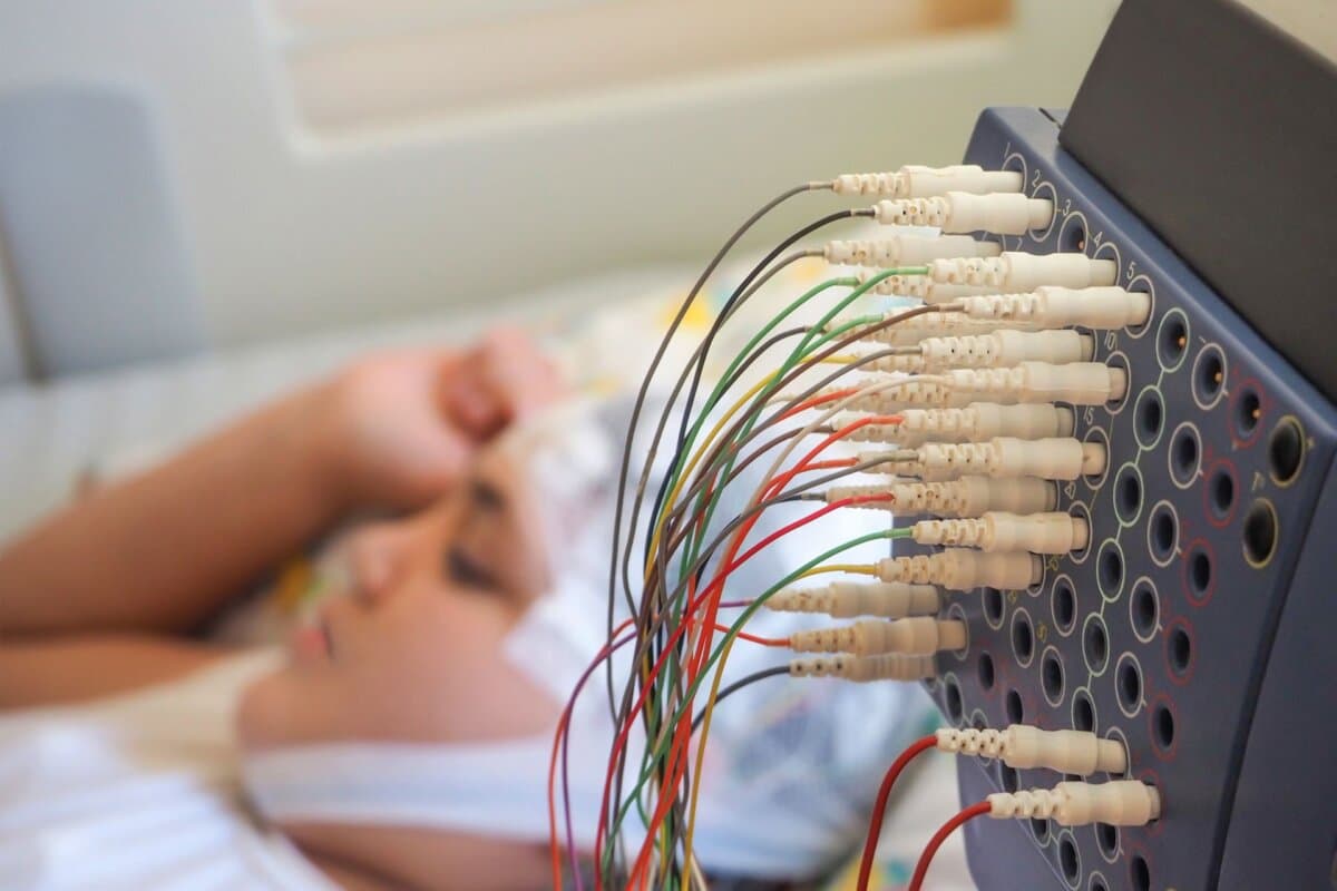 Patientin mit EEG-Elektroden zur neurologischen Diagnostik.