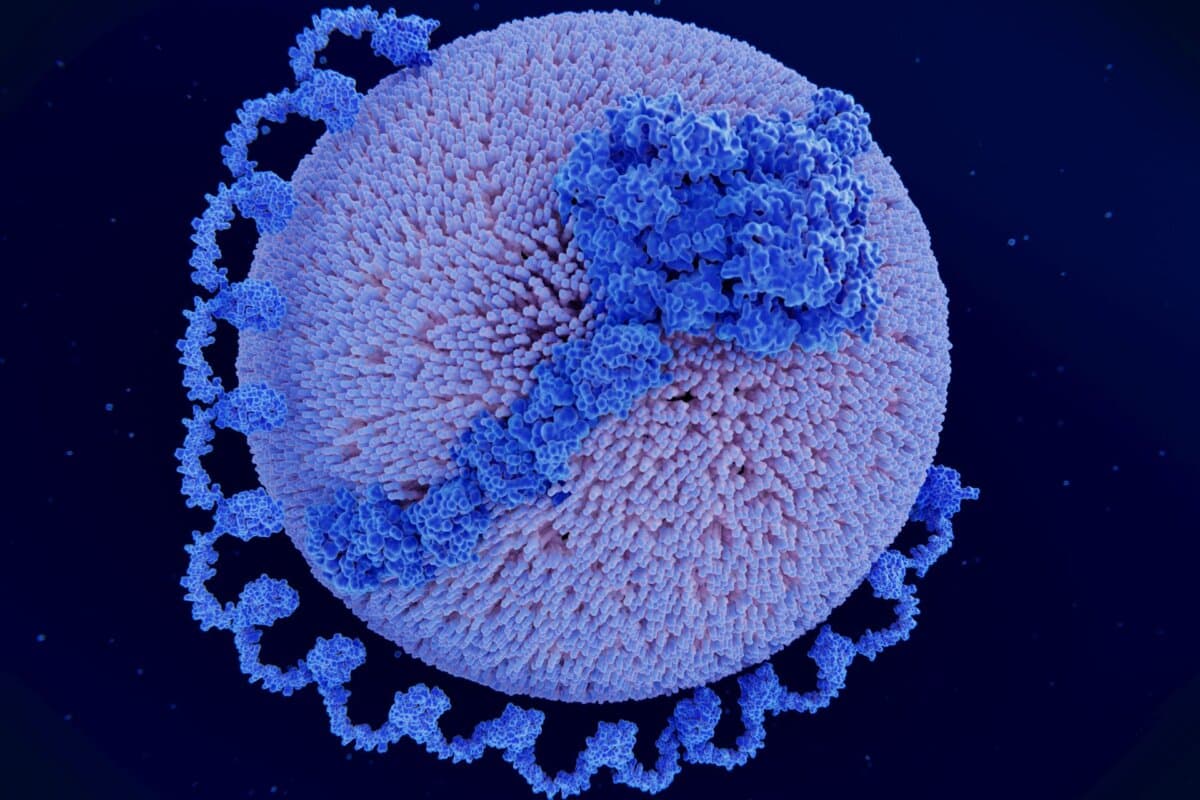Lipoprotein(a) ist ein LDL-ähnliches Partikel mit zusätzlichem Apolipoprotein(a) (hellblaue Kette).