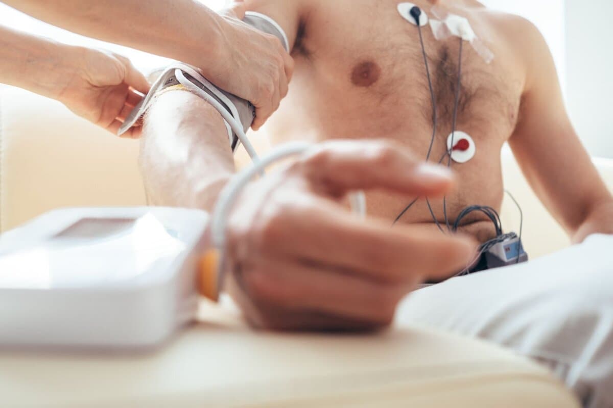 EKG