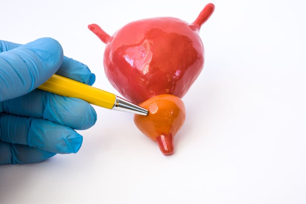 Anatomisches Modell von Harnblase und Prostata zur Veranschaulichung der Anatomie der Prostata.