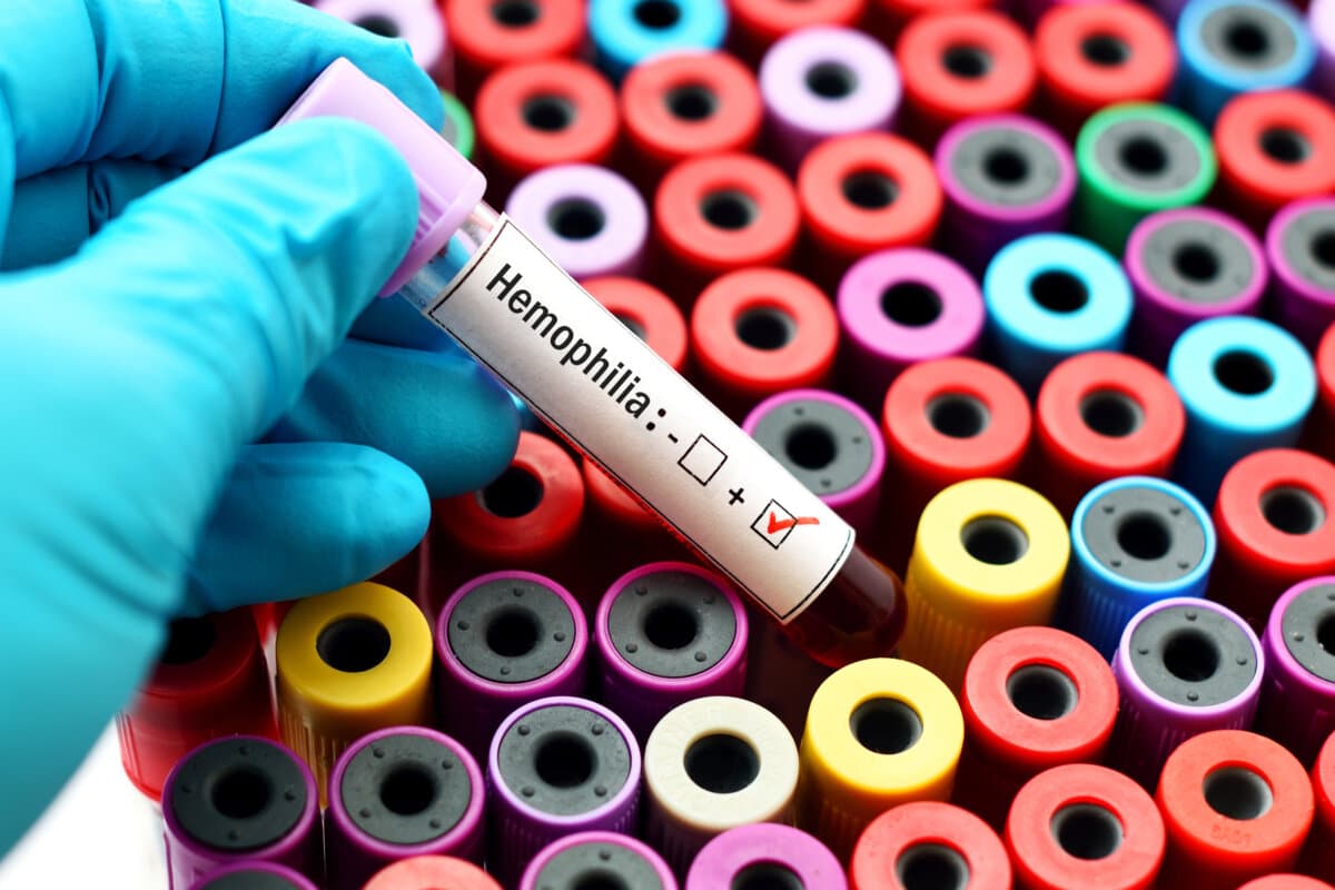 Welche Trends das Schweizerische Hämophilie-Register zeigt