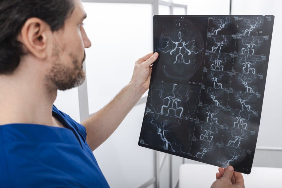Neurologe beurteilt MR-angiografische Aufnahmen der Hirngefässe bei einem Patienten mit Verdacht auf einen akuten