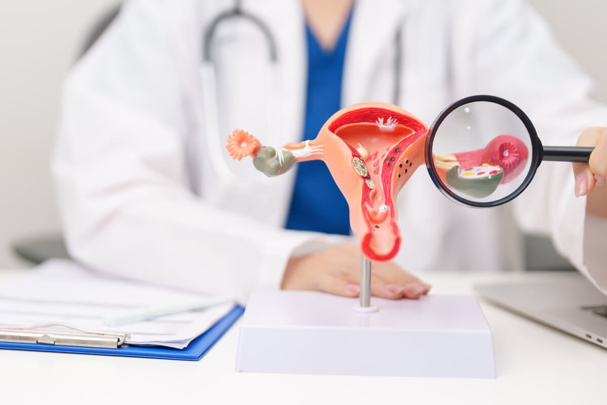 Doctor with Uterus and Ovaries anatomy model.