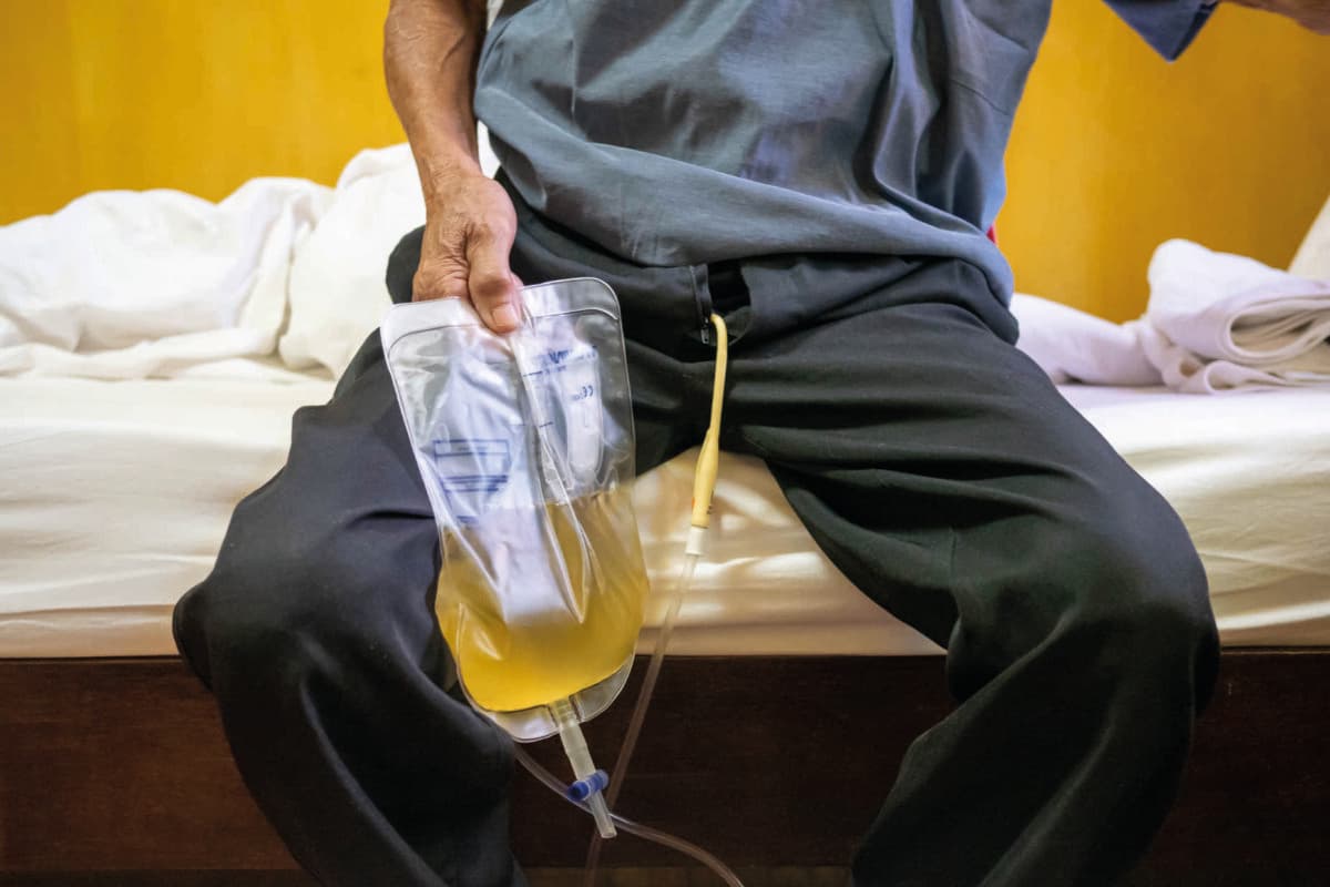 An Asian old man is an enlarged prostate gland that needs to be