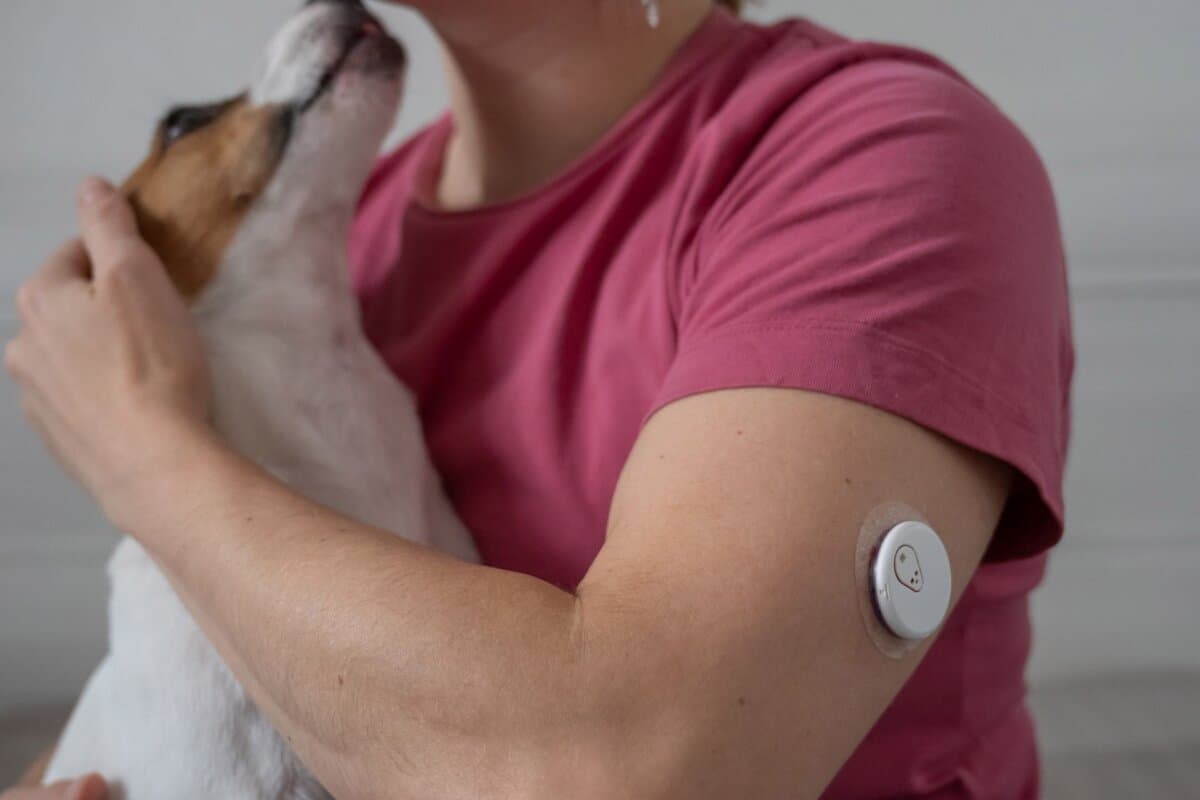 Frau mit CGM, die einen Hund kuschelt