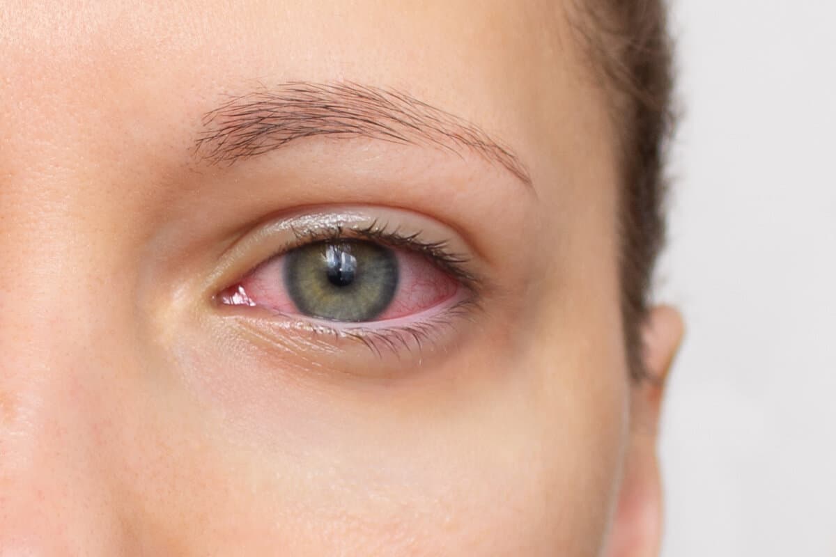 Sjögren-Syndrom: Frühe Schäden im Blick behalten