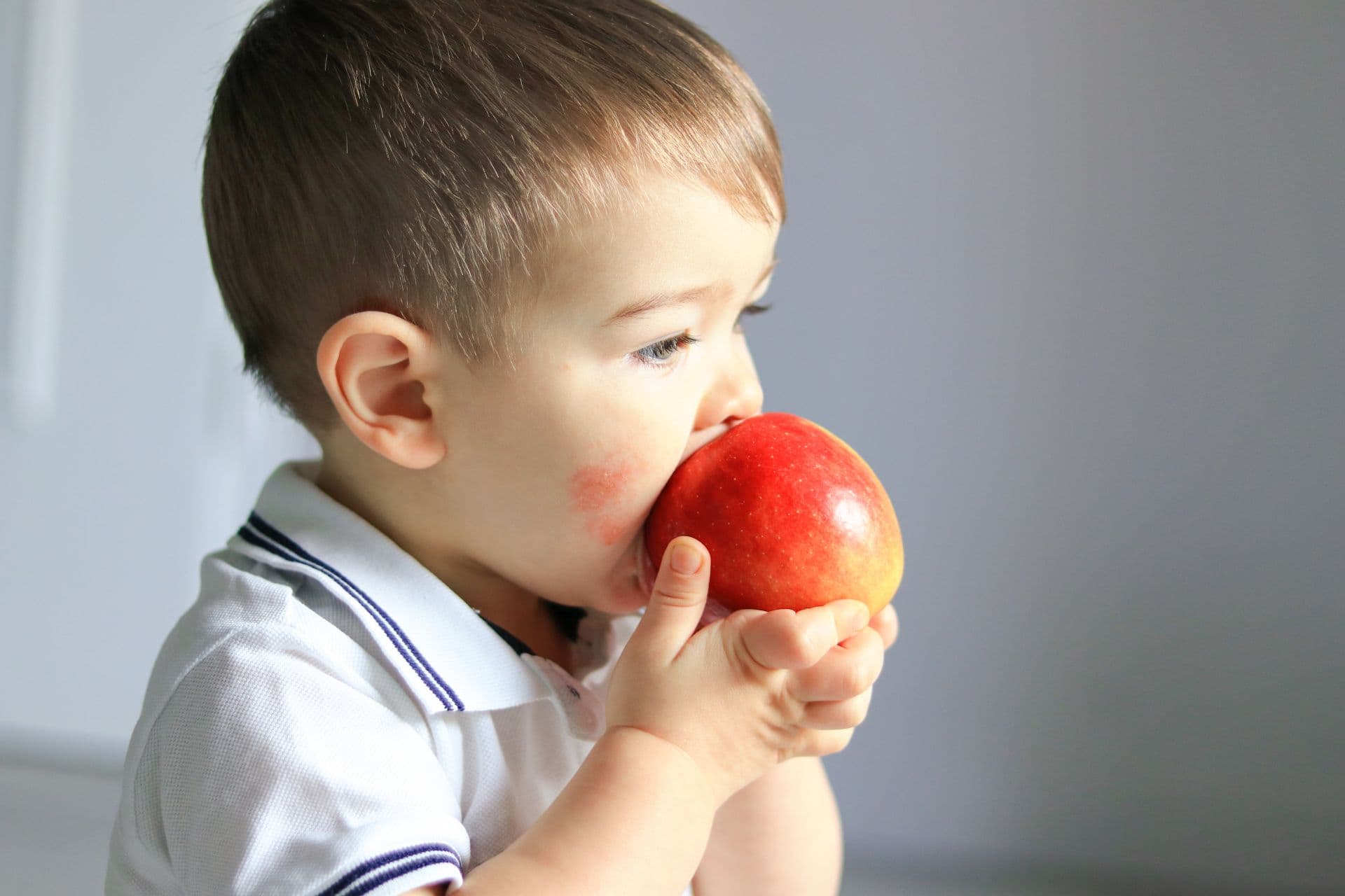 Patienten mit Neurodermitis müssen ihre Ernährung im Normalfall nicht einschränken.