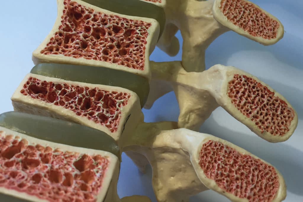 Anorexie, Colitis ulcerosa oder Schwangerschaft: Eine prämenopausale Osteoporose kann viele Ursachen haben.
