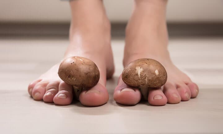 Close-up Of A Woman's Feet With Edible Mushrooms Between The Toes