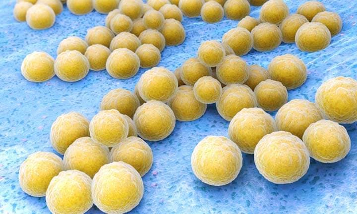 Staphylococcus aureus