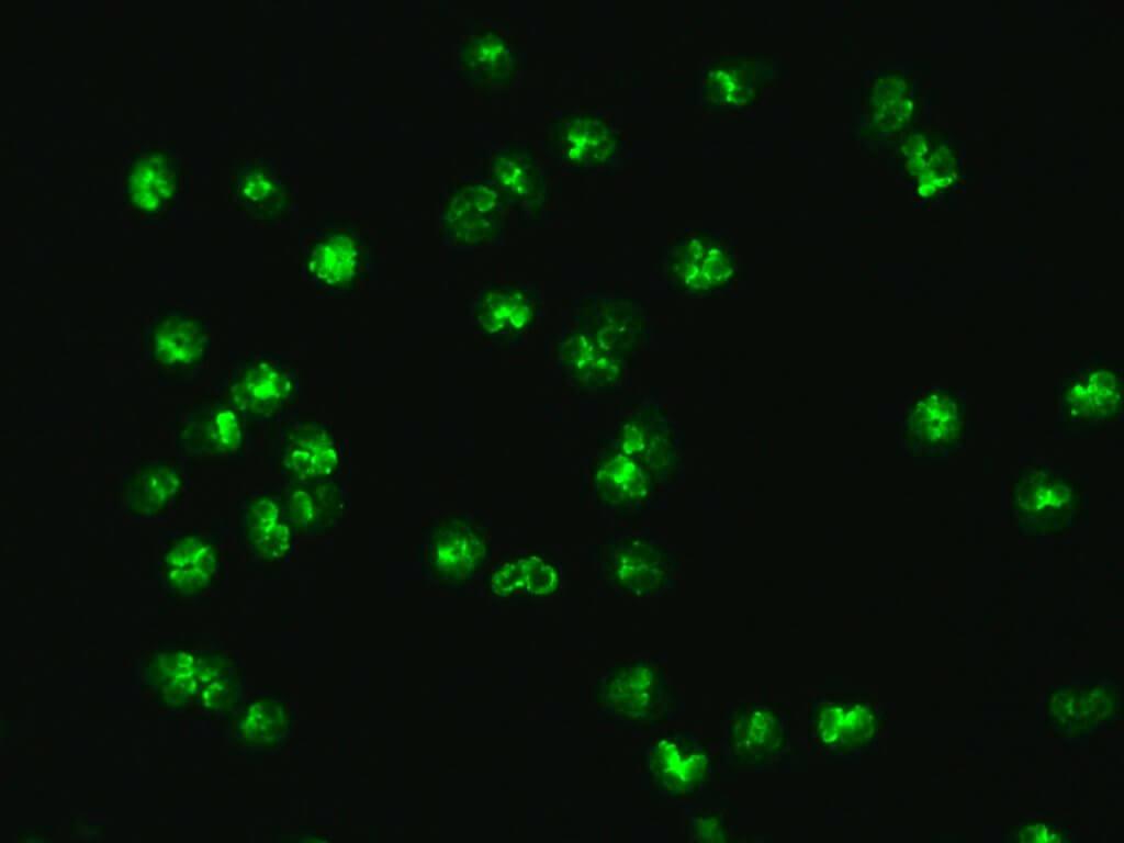 P-ANCA visualisiert durch Immunfluoreszenz auf Neutrophilen.