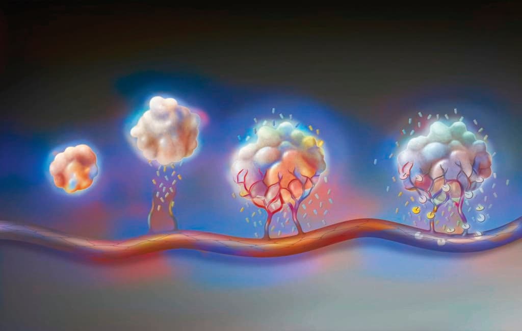 Tumor: from left to right, angiogenesis and antiangiogenic drugs.