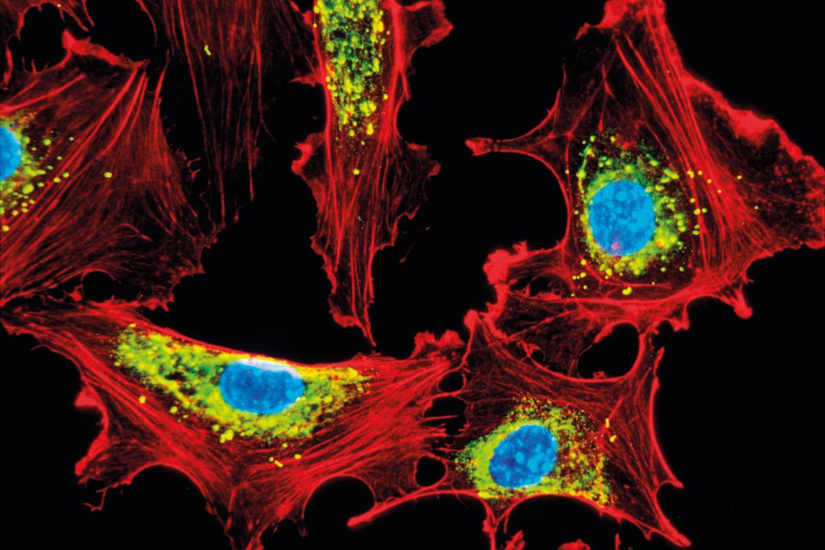 Human endothelial cells. Light micrograph of cultured human endothelial cells,a cell type found lining the blood vessels. Fluorescent dyes have been used to show the cell structures. Actin filaments are red,the cell nuclei are blue,and microcorpuscules containing Von Willebrand factor are yellow. Actin is the most abundant cellular protein,forming part of the cells' cytoskeleton,the system that is