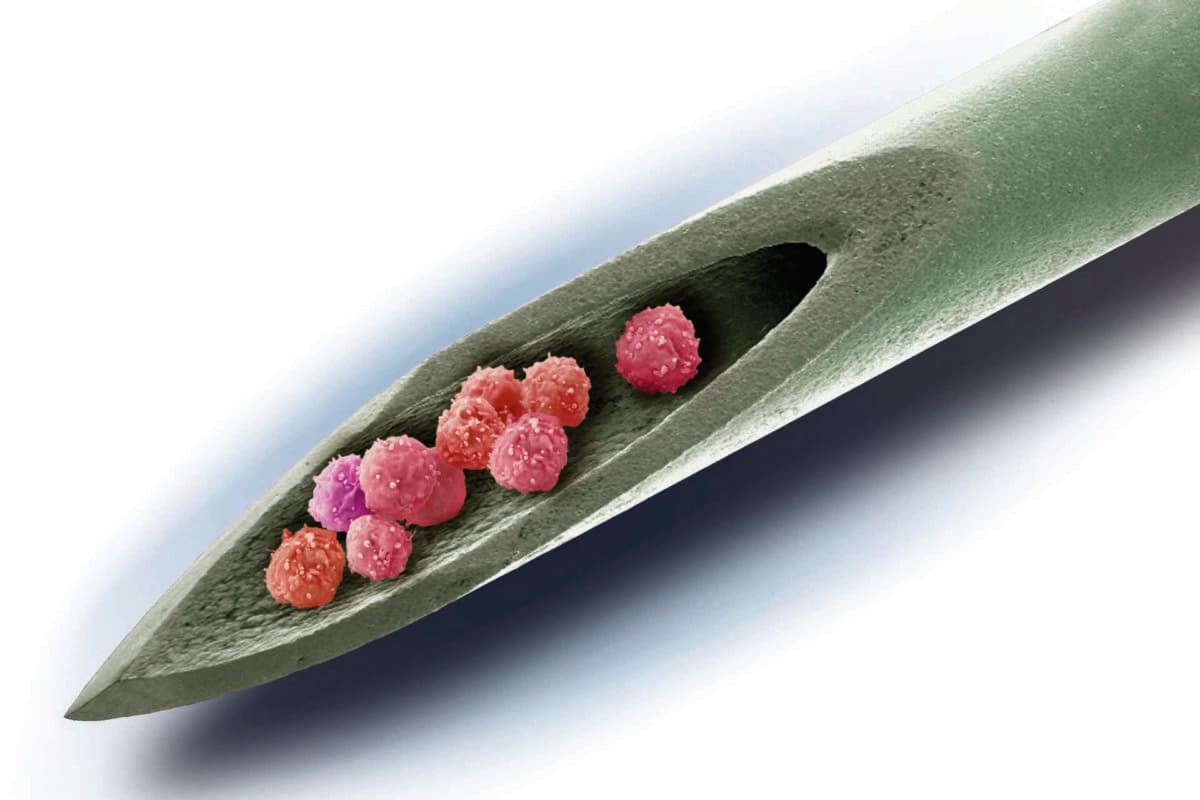 Stem cell therapy,conceptual image. Composite coloured scanning electron micrograph (SEM) of a needle with stem cells inside