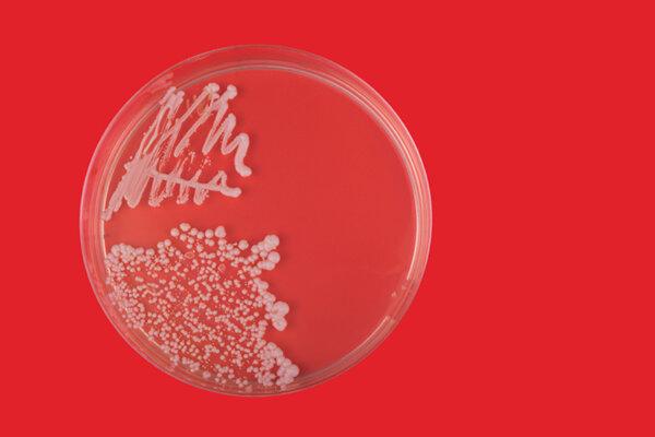 Petri dish with bacteria on red background.