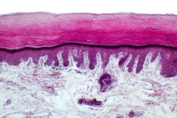 Peau humaine. Micrographie en lumière du tissu épithélial de la peau. Coupe d'un doigt humain montrant l'épiderme (épithélium pavimenteux stratifié), le derme et les tissus conjonctifs. Coloration à l'hématoxyline et à l'éosine.