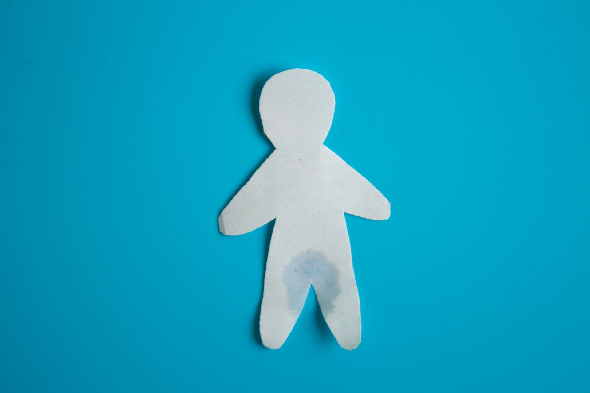 Nach einer radikalen Prostatektomie leiden die meisten Männer am Anfang unter Inkontinenz.