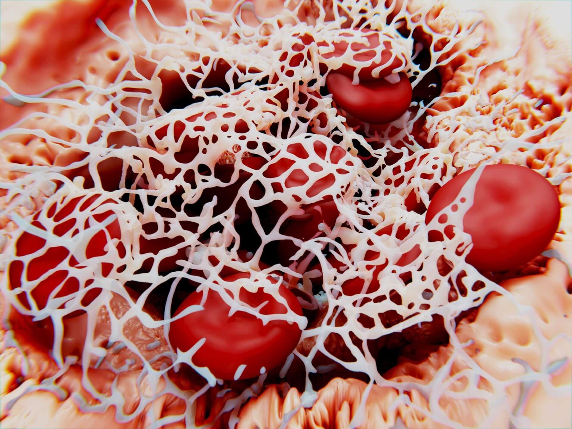 Die beiden Therapeutika Efanesoctocog Alfa und Emicizumab könnten künftig die Prophylaxe bei Patienten mit Hämophilie A verbessern.